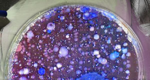 Bakterien im Innenraum